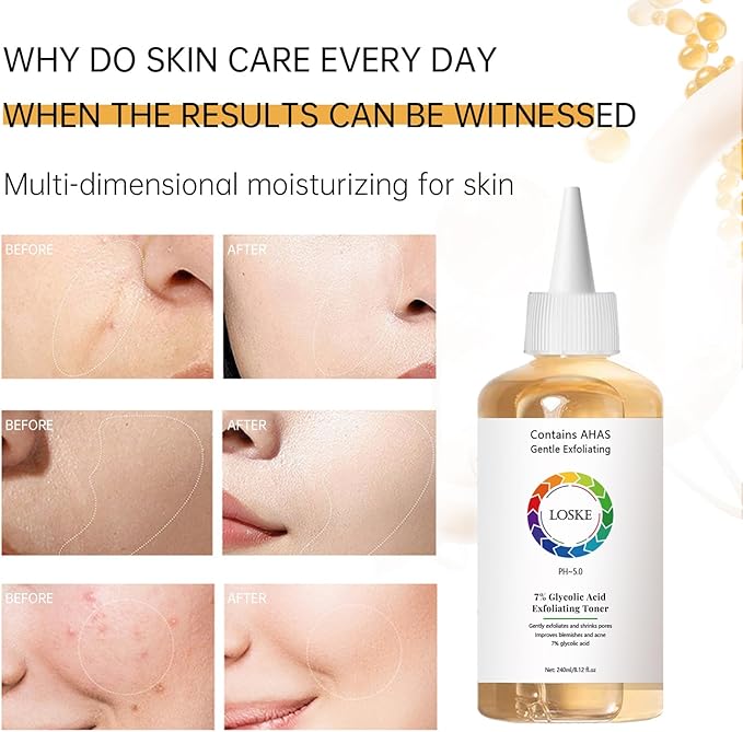 7% Glycolic Acid Face Exfoliating Toner for Clear Skin, Pore Minimizer, Radiant Complexion Enhancer, Daily Use Gentle Formula Suitable for All Skin Types
