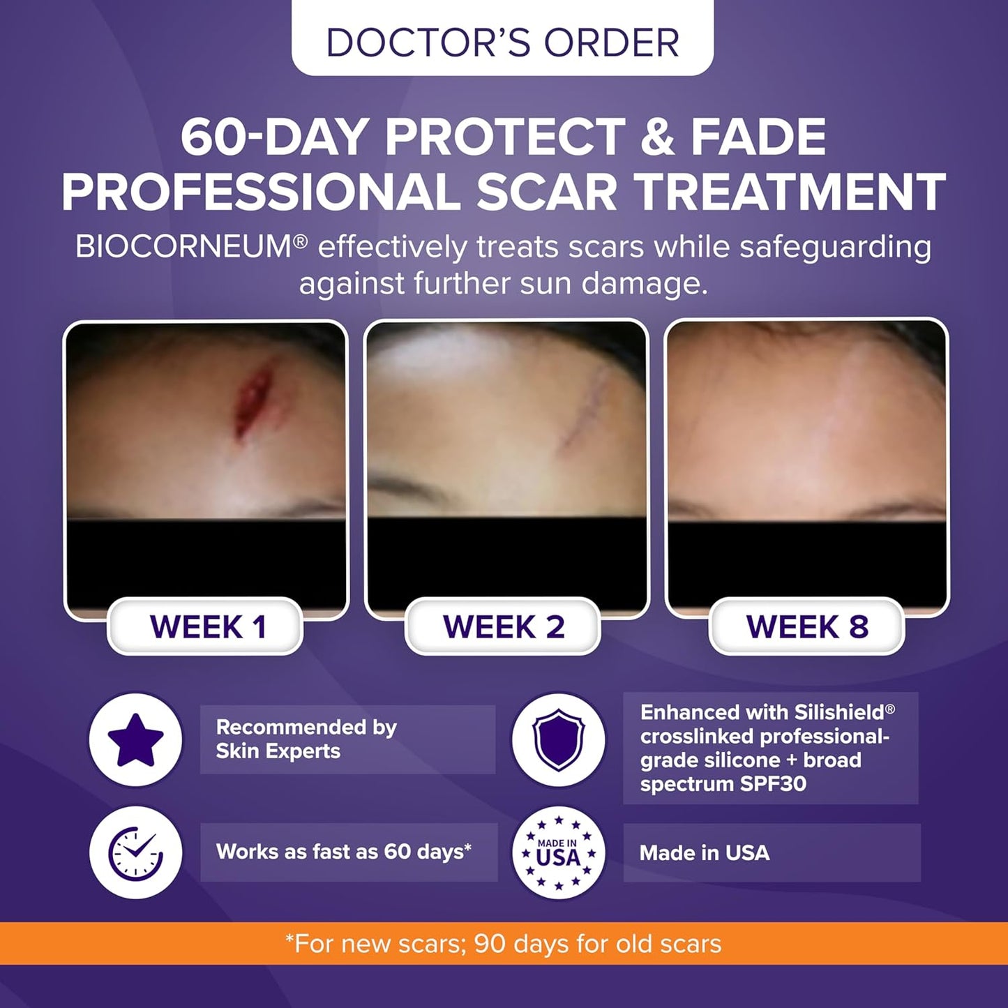 Biocorneum Advanced Scar Treatment with Silishield® & SPF 30 20g – Fast-Drying, Water-Resistant Silicone Scar Gel - Surgeon Recommended Scar Removal for New & Old Scars - Suitable for Children
